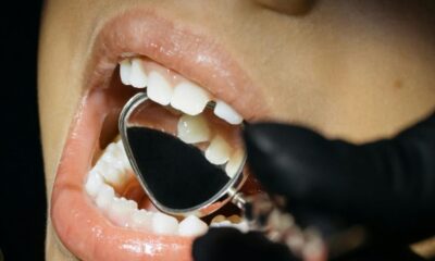 Gigi Anak Tanpa Gigi Berlubang