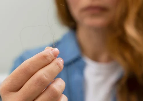 5 Kebiasaan Buruk yang Menyebabkan Rambut Rontok