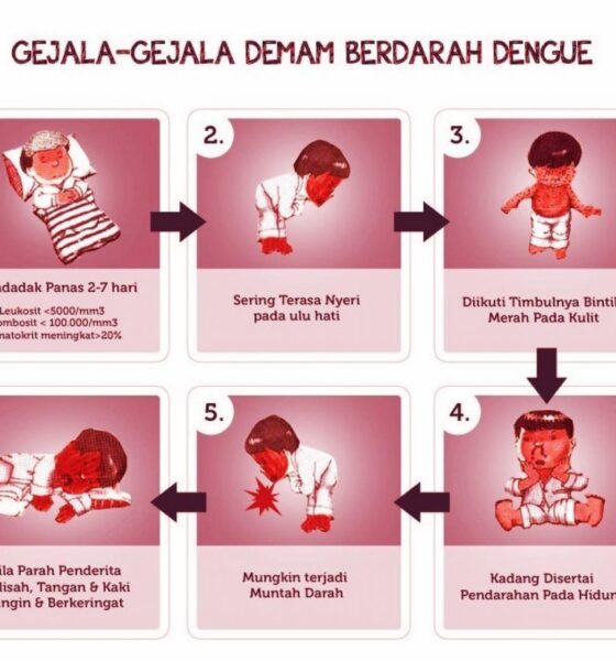 sedang 1571037026Gejala DBD Pada Anak Usia 1 dan 2 Tahun