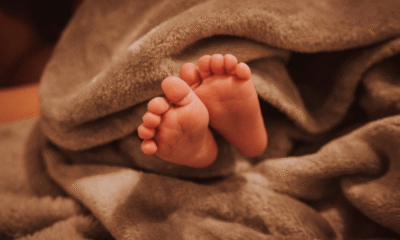 apa perbedaan antara dwarfisme dan kretinisme