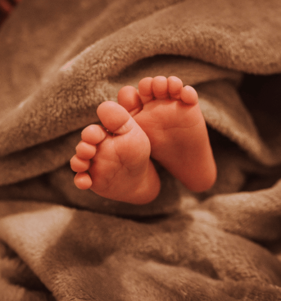 apa perbedaan antara dwarfisme dan kretinisme