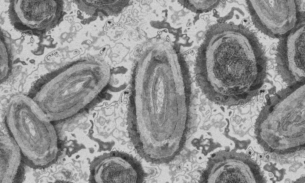 kasus pertama infeksi virus shamonda pada manusia