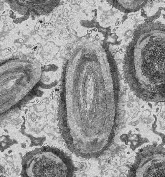 kasus pertama infeksi virus shamonda pada manusia