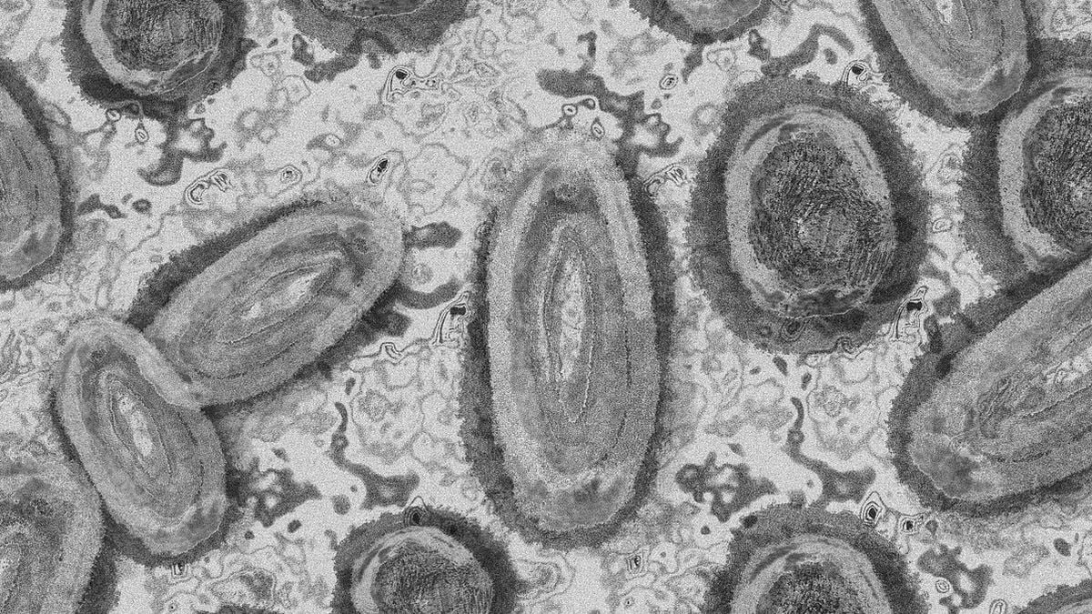 kasus pertama infeksi virus shamonda pada manusia